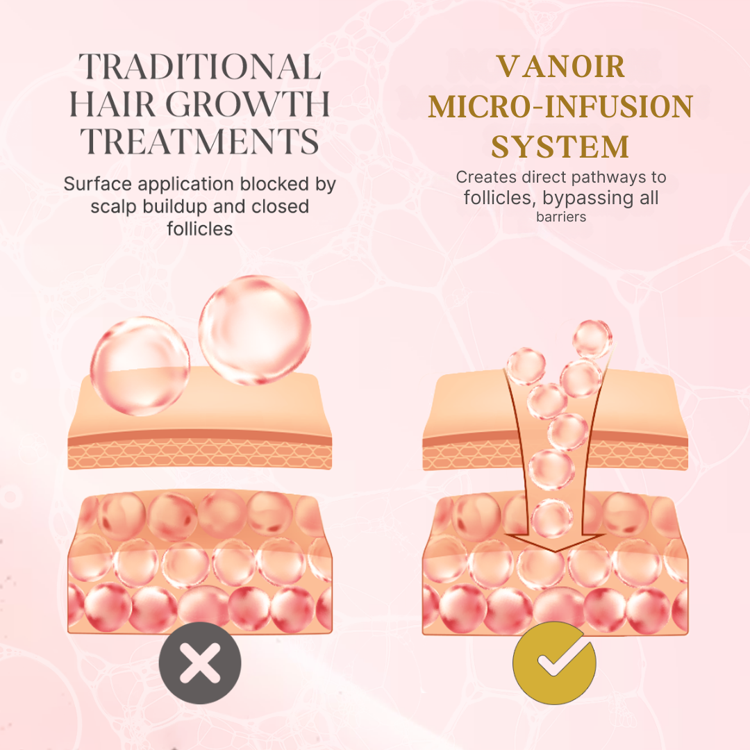Hair Regrowth Micro-Infusion Protocol