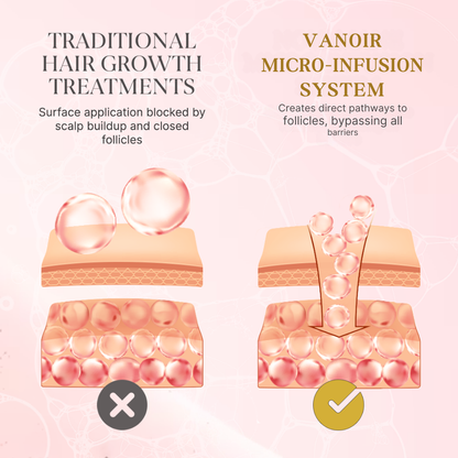 Hair Regrowth Micro-Infusion Protocol