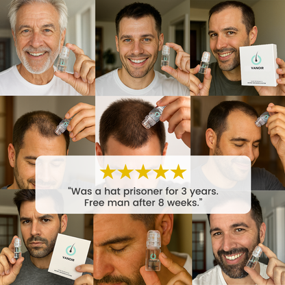 Hair Regrowth Micro-Infusion Protocol
