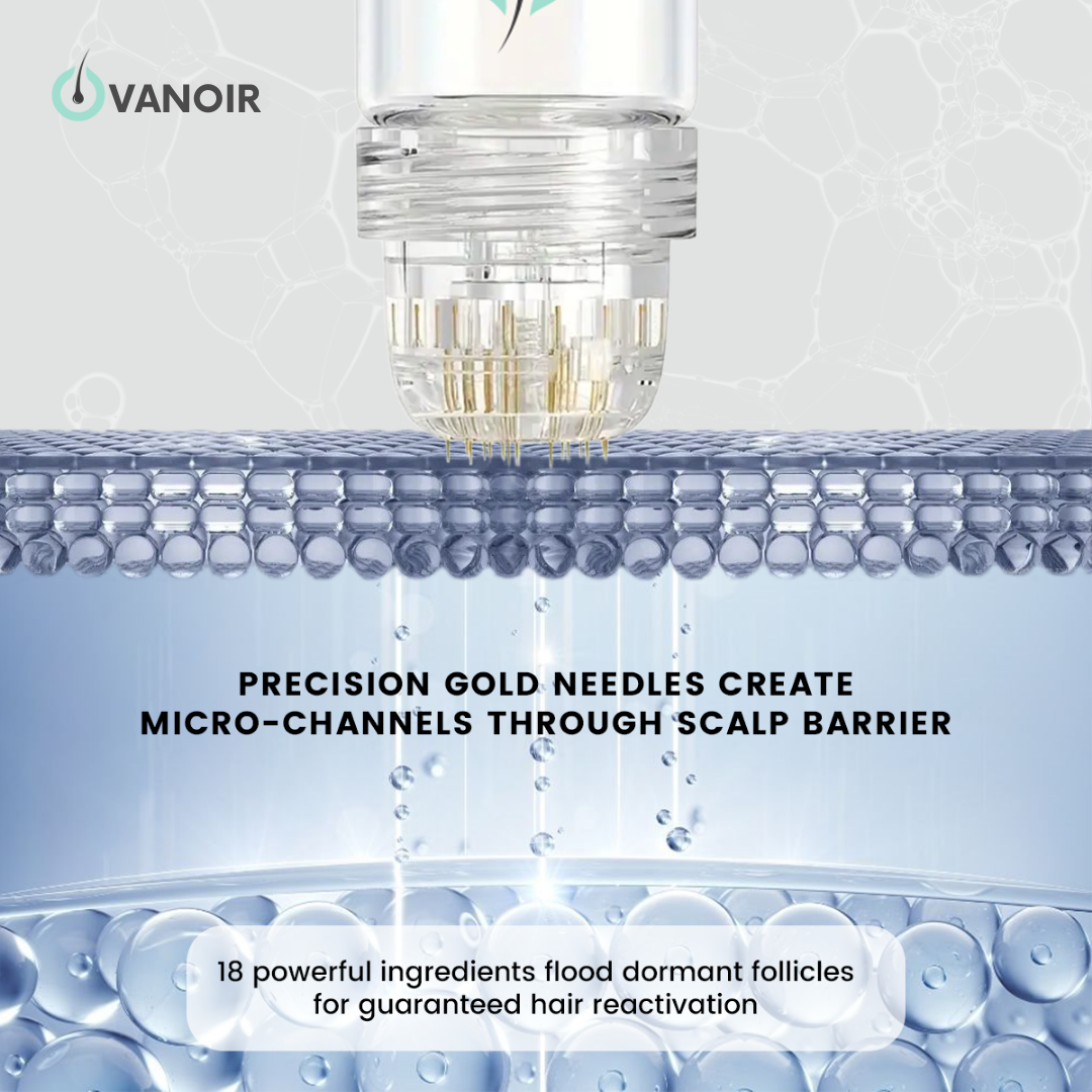 Hair Regrowth Micro-Infusion System