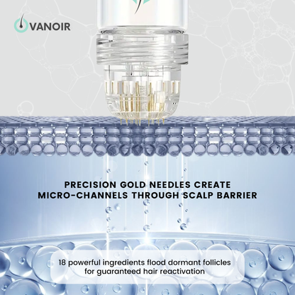 Hair Regrowth Micro-Infusion Protocol